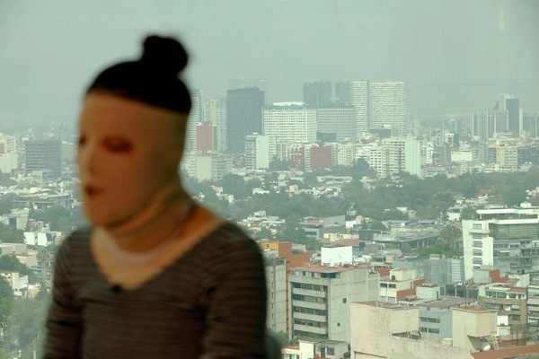 Saxofonista atacada con ácido denuncia dilación de justicia, a un año de ataque