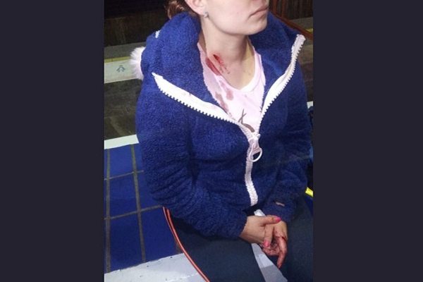 Asaltan y hieren a mujer policía al exterior del Metro Guelatao