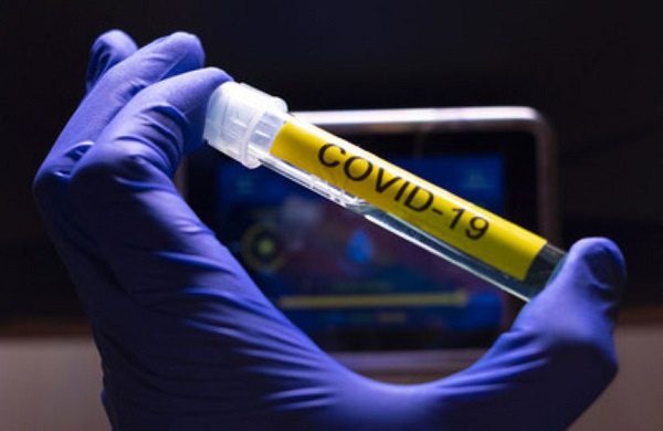 Al menos 26% de la población mundial se resistiría a recibir la vacuna contra el Covid-19