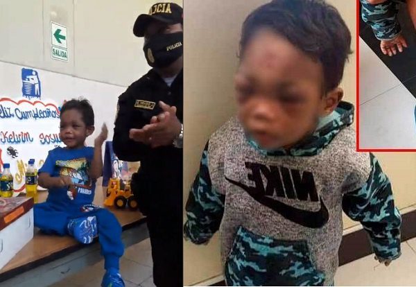 Policías y enfermeras celebran cumpleaños a niño golpeado por su padrastro #VIDEO