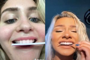 ¡Para no creerse! recomiendan en TikTok limarse los dientes #VIDEO