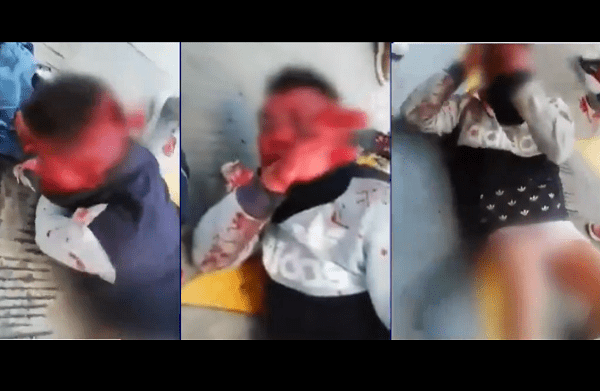 ¡Como Santo Cristo! Así dejaron a ladrón de combis en Los Reyes La Paz #VIDEO