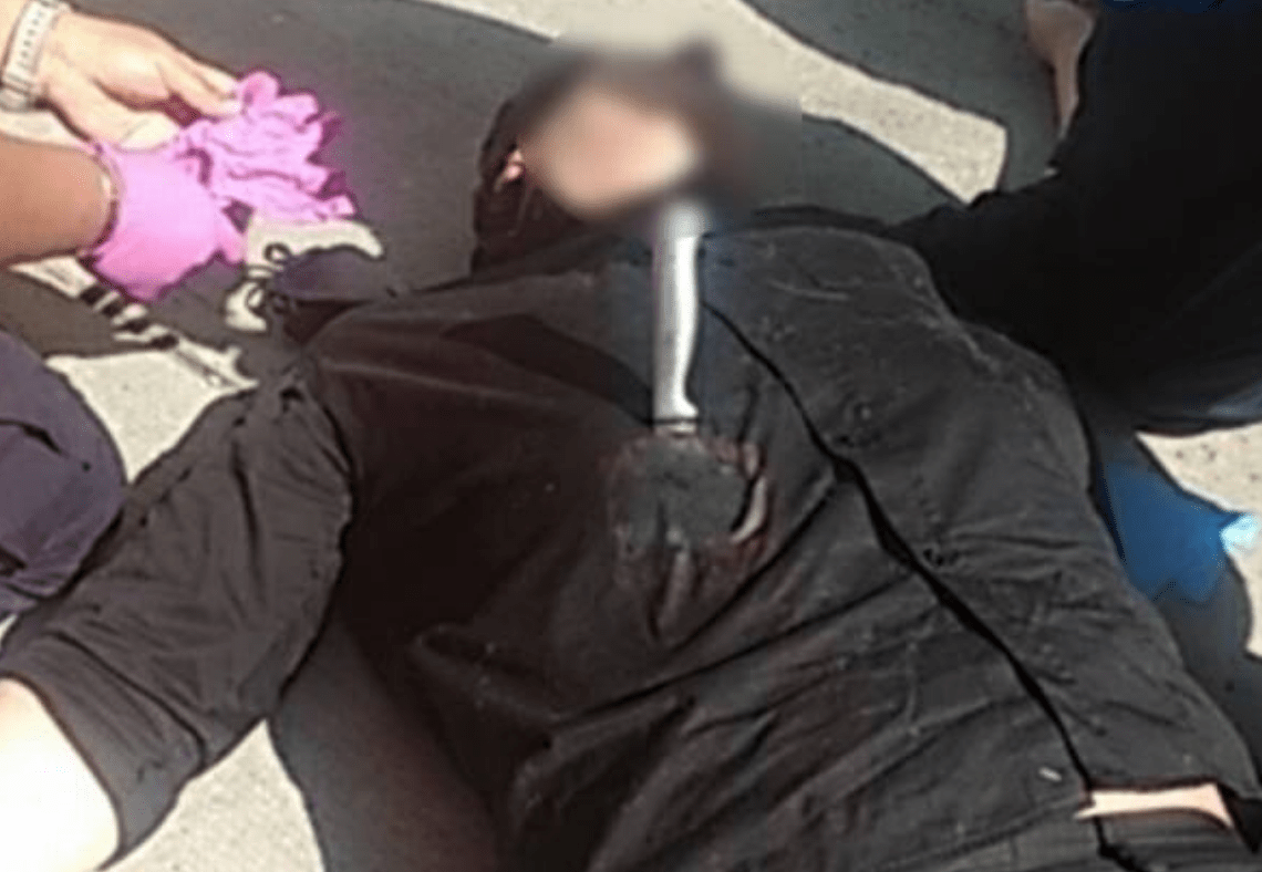 Hombre sobrevive al ser apuñalado tras asalto en Iztapalapa