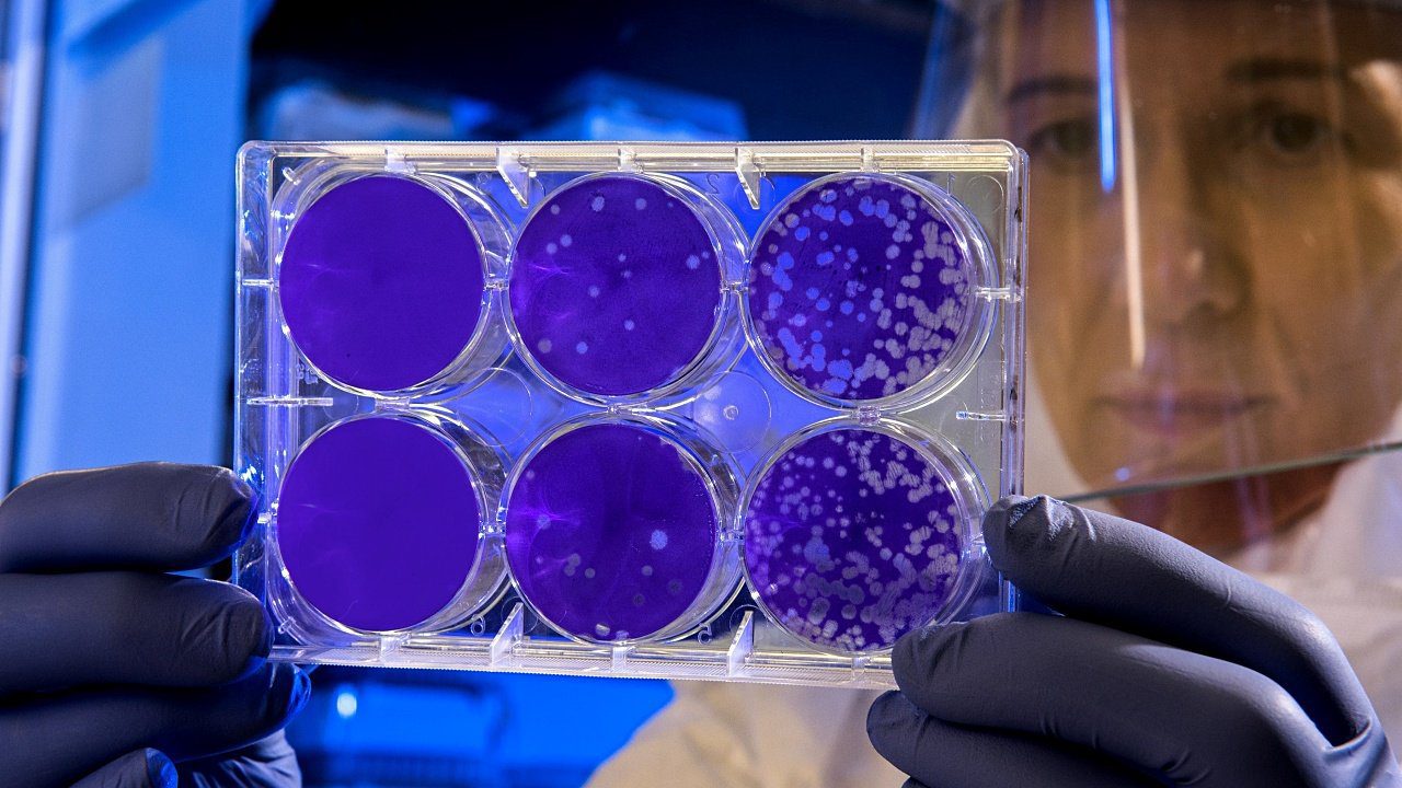 Estudian virus que genera infecciones, sin activar sistema inmune