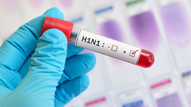 Confirman primer caso de Covid-19 e influenza en México