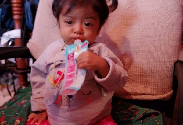 Ariadne, la pequeñita que necesitaba un trasplante de hígado, no pudo superar la cirugía