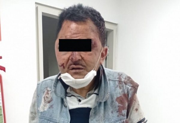 ¡Apaleado! Así acabó este sujeto al intentar asaltar la casa de un abuelito