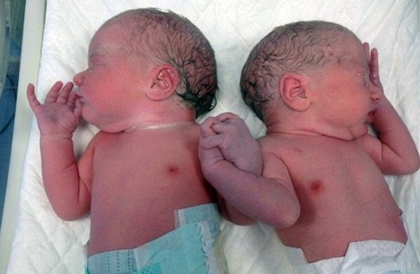 Abandonan a gemelos nacidos mediante subrogación de vientre por nacer enfermos
