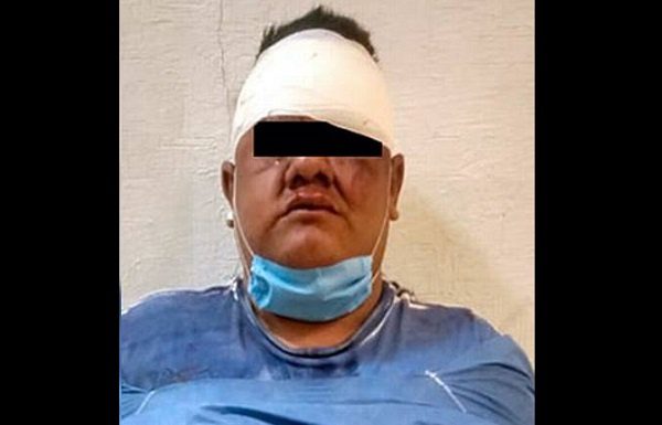 ¡Rata abandonada! Ladrón deja tirado a su cómplice cuando eran perseguidos por la policía