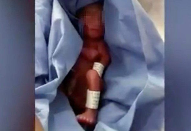 ¡Terrible! Descubren vivo a un bebé que estuvo horas refrigerador de una morgue #VIDEO