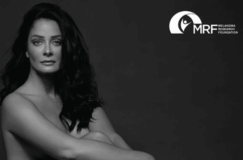 Dayanara Torres se quita la ropa para crear conciencia sobre el cáncer de piel