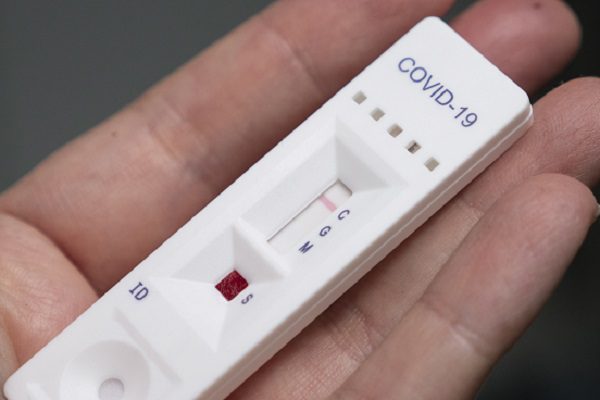Usuarios podrán hacerse la prueba de Covid-19 en estaciones del Metro