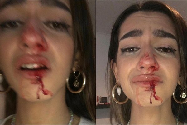 Joven denuncia brutal agresión tránsfoba en Barcelona