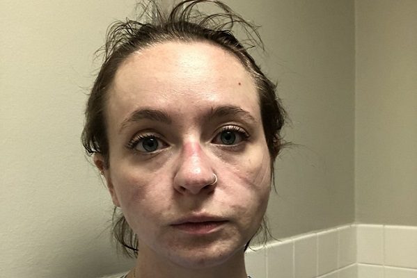 Enfermera de EU muestra cambio tras ocho meses de pandemia