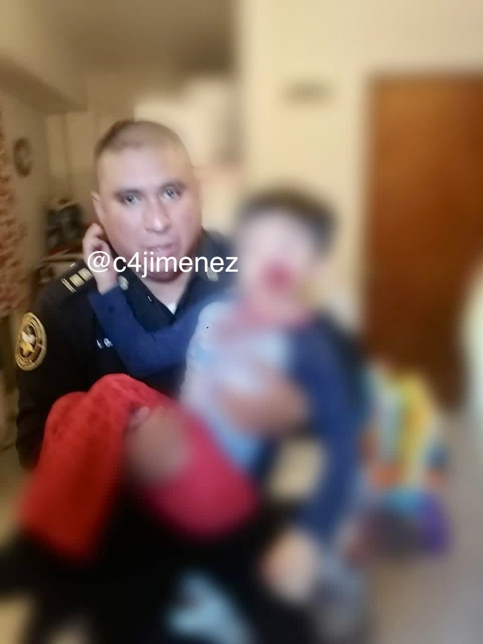 Pitbull muerde a niño en Iztapalapa, CDMX