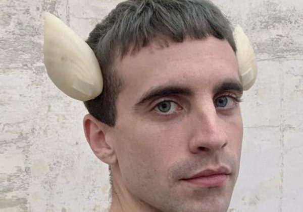 Joven se implanta "aletas de pez" en el cráneo al considerarse transespecie