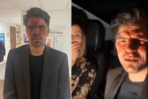 Golpean a hijo menor de Lupita D'Alessio por defender a su novia, responsabiliza a Arturo Montiel
