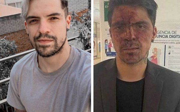 Rechaza hijo de Arturo Montiel agresión contra César D'Alessio