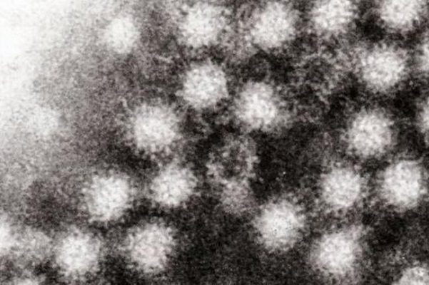 China alerta brote de Norovirus en 50 niños