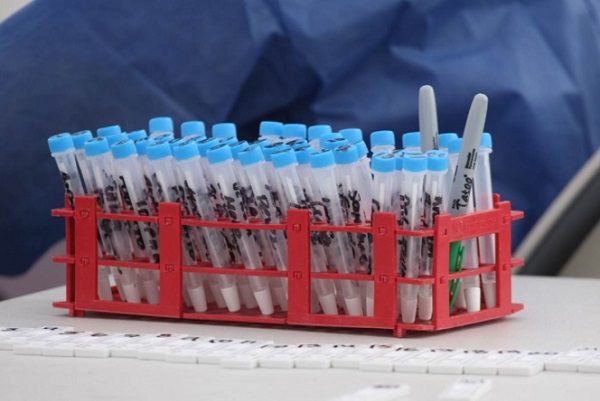 Alertan robo de vehículo con muestras de Covid-19, en Edomex