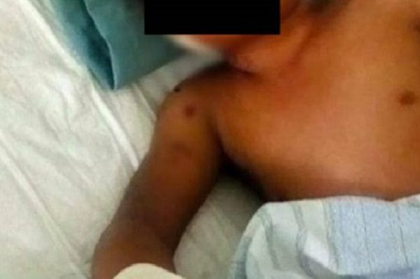 Pequeño de nueve años pierde una mano por jugar con cohetes, en Oaxaca