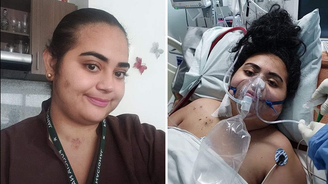 Tras pasar más de dos meses internada por COVID-19, médica tuvo que aprender de nuevo a hablar y a escribir