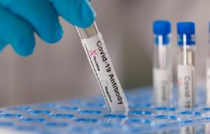 Roche se asocia con Moderna para incluir prueba de anticuerpos durante ensayos de la vacuna COVID-19