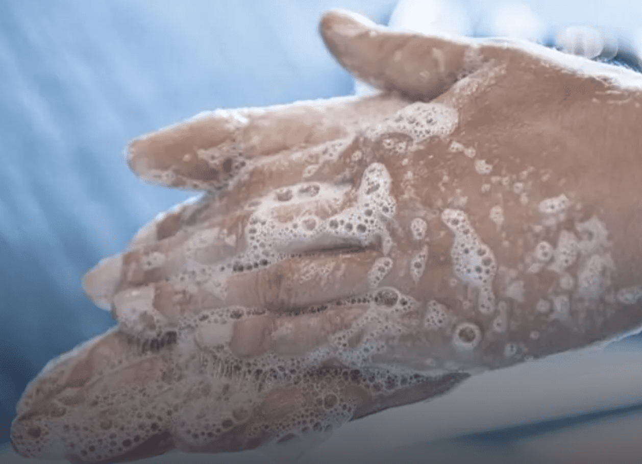 Covid-19 sobrevive en la piel hasta 9 horas, afirma estudio