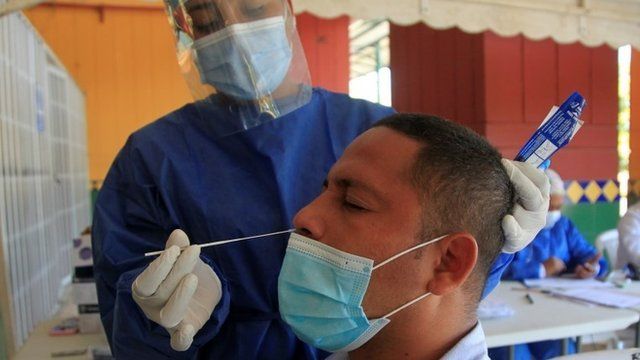 Este es el factor que eleva contagio de la cepa británica de COVID-19