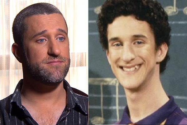 ¿Recuerdas a Screech? El actor Dustin Diamond padece cáncer terminal