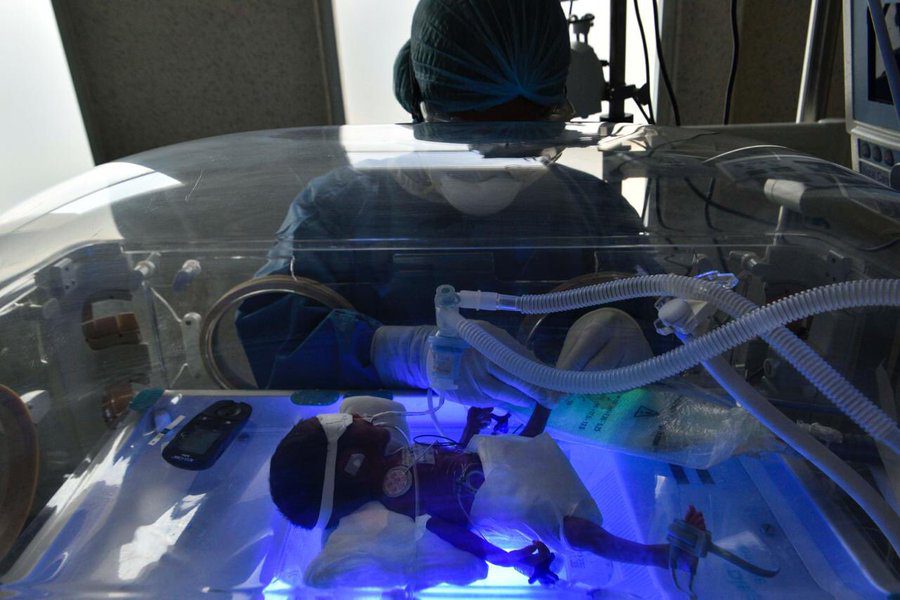 69 bebés con COVID-19 nacieron en 2020 en hospital de Toluca, uno murió