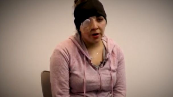 Piden tipificar como violencia de género ataques con ácido