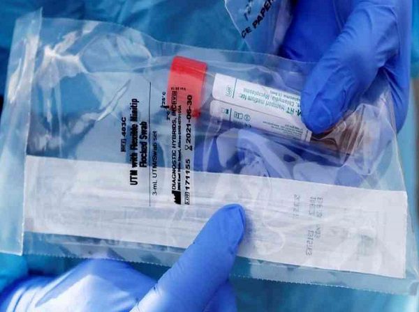 En la GAM roban camioneta con reactivos para prueba covid-19