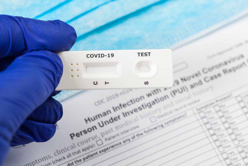 Farmacias y centros comerciales harán pruebas COVID-19 gratuitas en CDMX