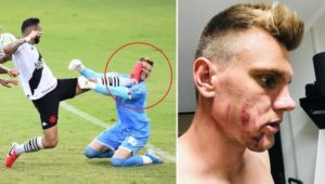 Portero brasileño sufre patada en la cara. No saben cuándo volverá a jugar