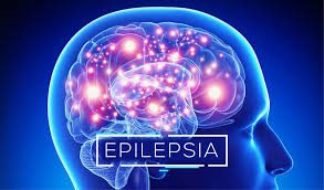 Pandemia provoca aumento de casos de epilepsia sin diagnóstico