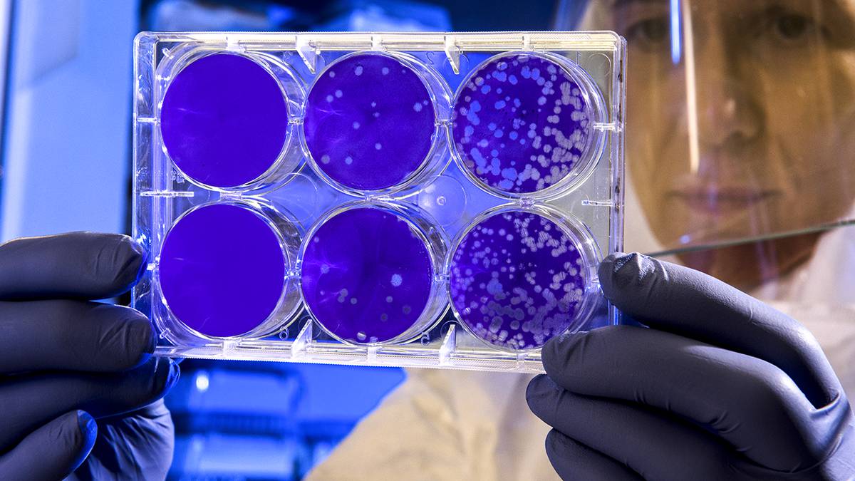 Esto se sabe de la cepa californiana de Covid-19, detectada en España