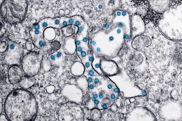 Detectan caso de variante india “doble mutante” de Covid-19 en California