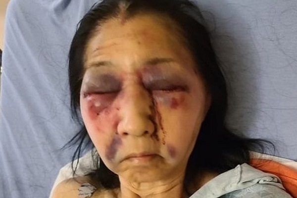 Mujer afroamericana ataca a mexicana al confundirla con asiática