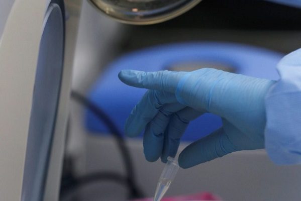 Detectan primer caso de la variante británica de Covid-19 en Yucatán