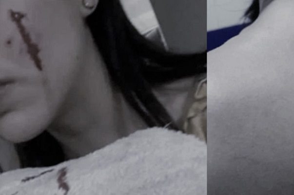 Novia de presunto asesino de Rodolfo Corazón revela supuestas heridas