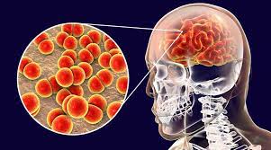 Resaltan importancia de reforzar programas de inmunización para prevenir meningitis
