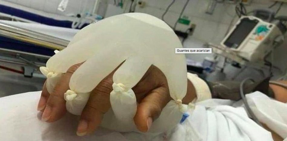 Enfermeras idean guantes de látex para acompañar a pacientes covid-19