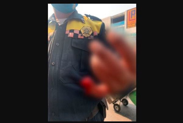 Conductor le arranca pedazo de dedo a policía por ponerle "araña" #VIDEO