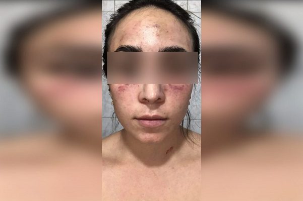 Mujer embarazada acusa haber sido golpeada por sobrino de candidata #VIDEO