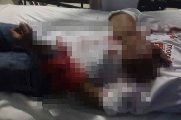 Balean a candidato de Morena en Puebla; está estable