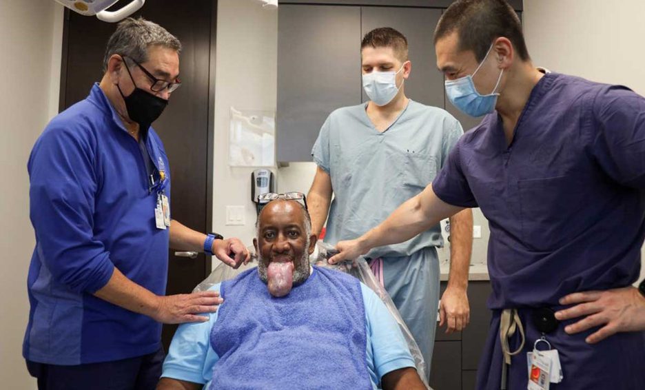 Paciente grave de covid-19 desarrolla hinchazón extrema de su lengua en EU