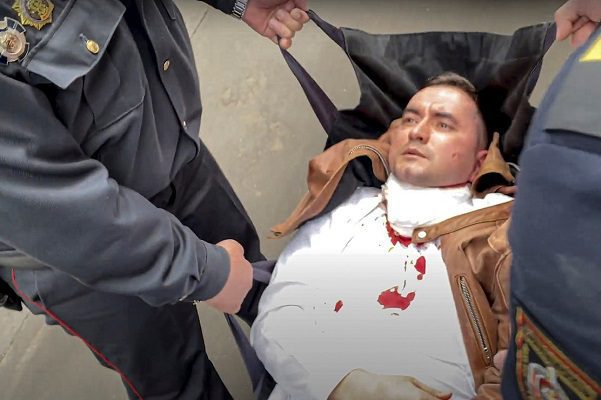 Activista bielorruso se clava una pluma en el cuello tras amenazas de autoridades