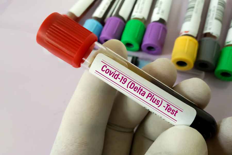 Incremento de casos de covid-19 en Europa es desigual respecto a la variante Delta