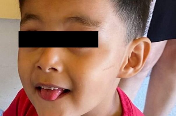 Niño de tres años muere tras una visita rutinaria al dentista
